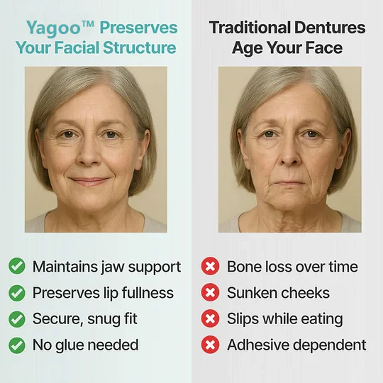 🏆Ends Today: 70% OFF! Yagoo™ Custom Custom-Fit Full Functional DenturesMake you more confident – Made in the USA & FDA-Certified